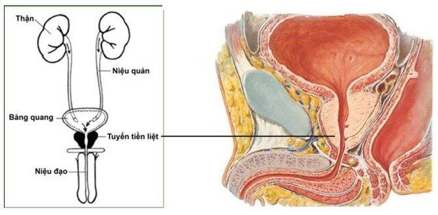 u tuyến tiền liệt