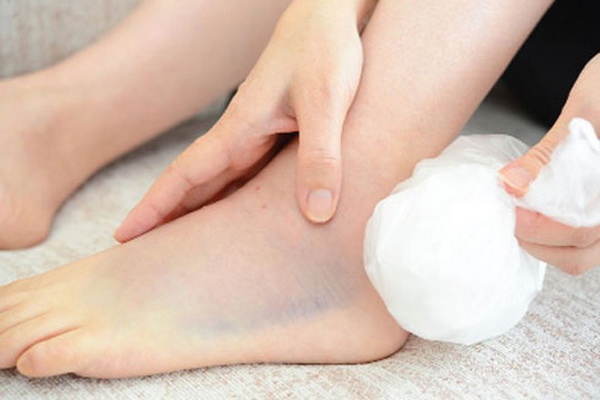 Chữa trị đứt gân gót chân