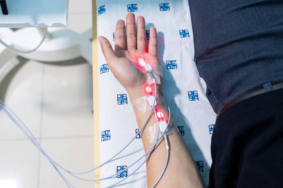 Phương pháp Laser châm điều trị hội chứng ống cổ tay