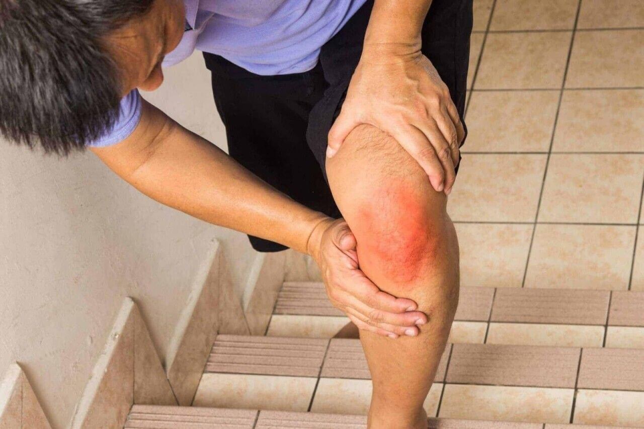 Nguyên nhân gây rách sụn chêm khớp gối và cách chữa trị hiệu quả