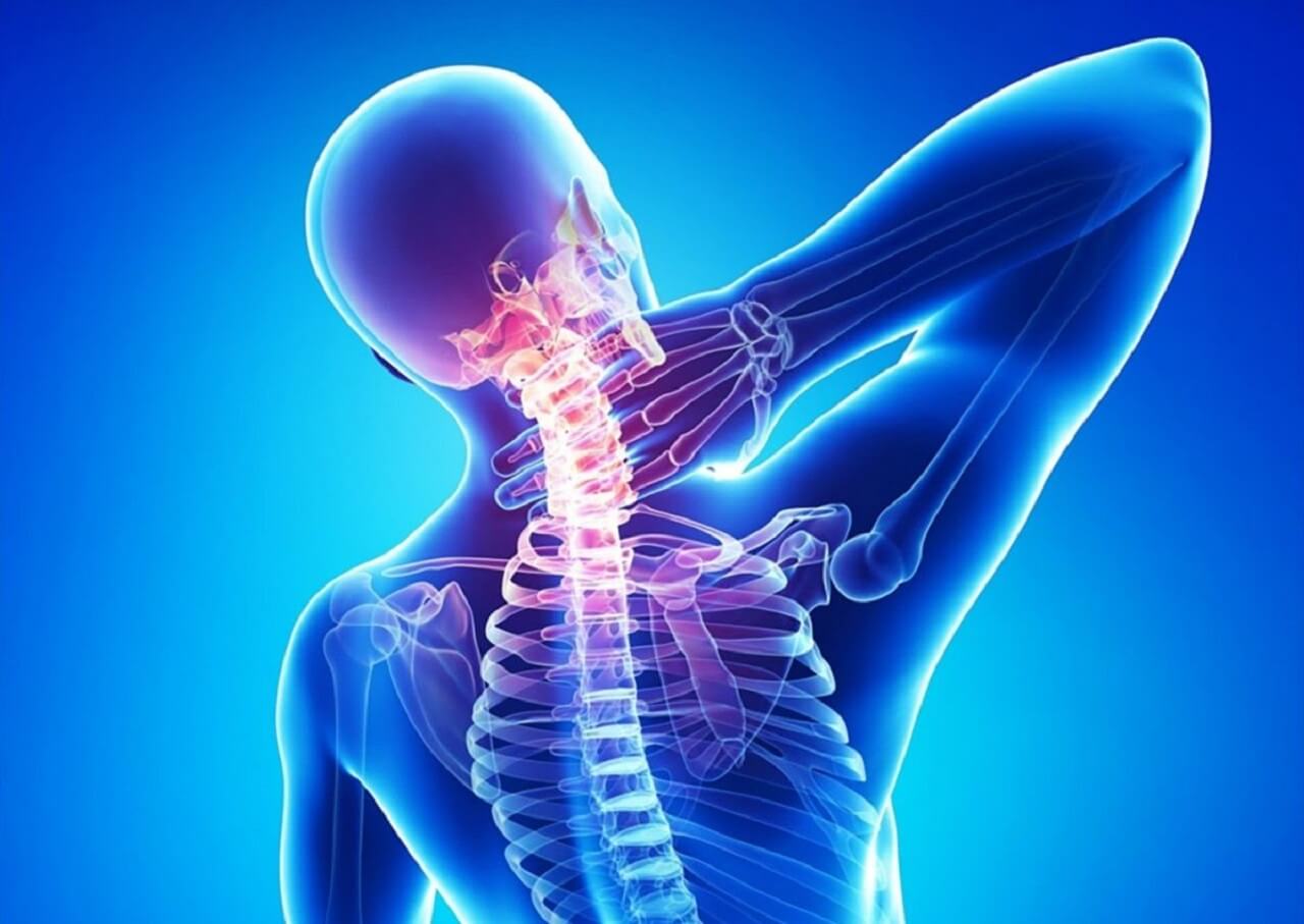 Chữa trị thoái hóa cột sống cổ