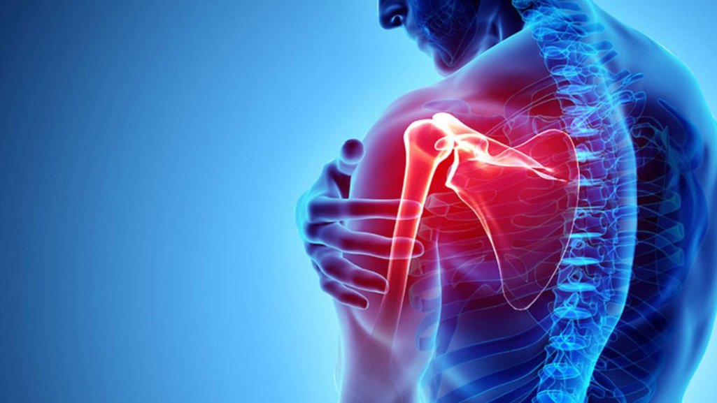 Chữa trị tràn dịch khớp vai