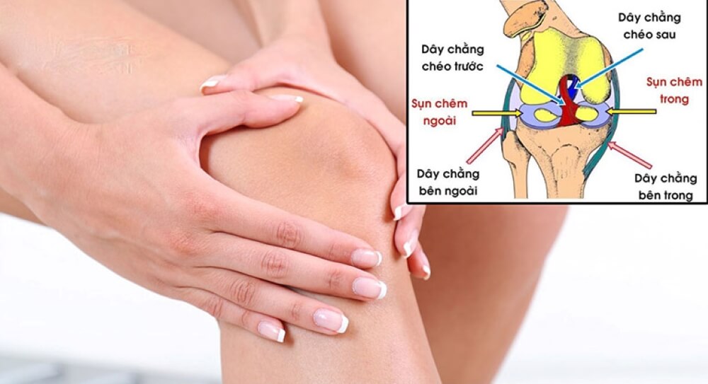 Đứt dây chằng là gì? Nguyên nhân và cách khắc phục an toàn và hiệu quả