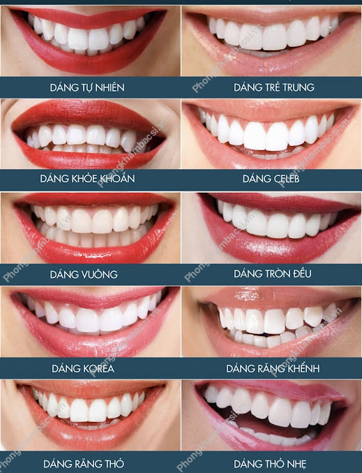 Nha Khoa Be Dental