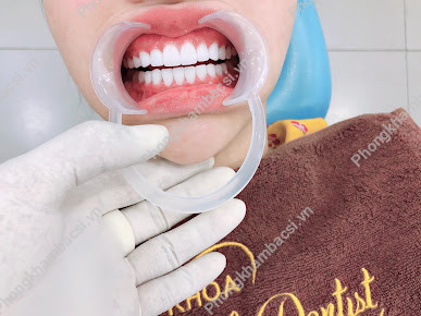 Nha khoa Cali Dentist