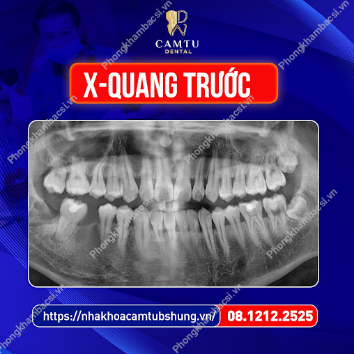Nha Khoa Cẩm Tú