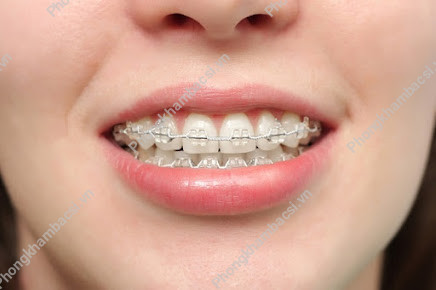Nha Khoa My Smile