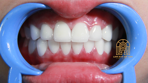 Phòng khám Nha Khoa Lam Anh - 329 Đ. Cách Mạng Tháng 8, Phường 12