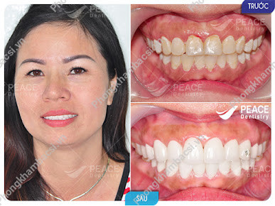 Nha Khoa Peace Dentistry