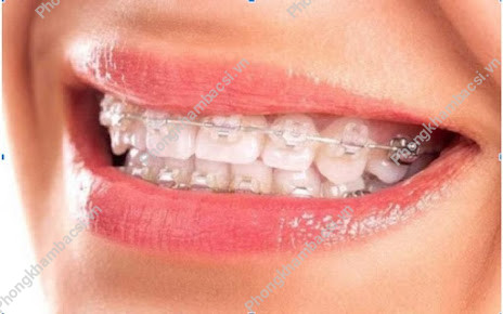Nha Khoa Quốc Tế Ruby Dental