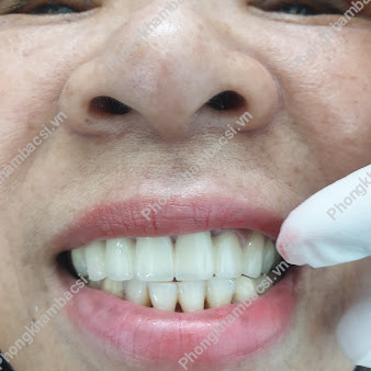 Nha Khoa Sài Gòn