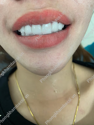 Phòng Khám Nha Khoa SÀI GÒN - 46 Ngô Gia Tự, Thanh Son