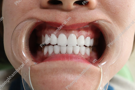 Phòng khám Nha Khoa Thẩm Mỹ Hà Nội - 163 Trần Hưng Đạo