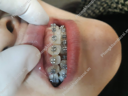 Phòng khám Nha Khoa Thẩm Mỹ Thắng Huế