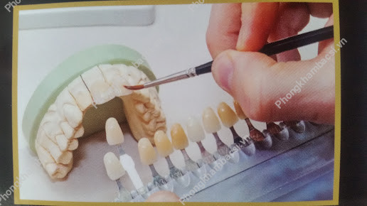 Nha khoa thẩm mỹ Thiện Hiệp (Phòng Khám - Bs Giang Xuân Thiện)