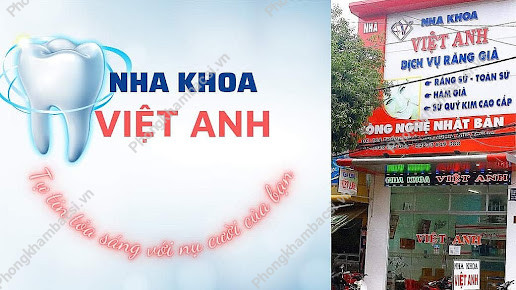 Nha Khoa Việt Anh
