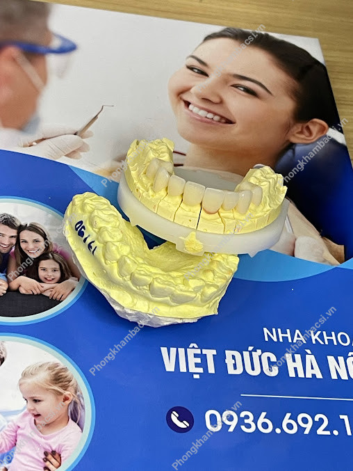 Nha Khoa Việt Đức