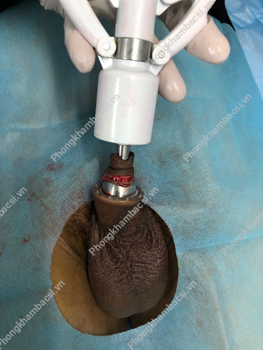 Phòng khám Nam Khoa Adam Health Care