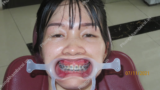 Phòng Khám Răng Hàm Mặt - BS Vũ Đức Tuyến