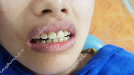 Nha Khoa Việt Nhật