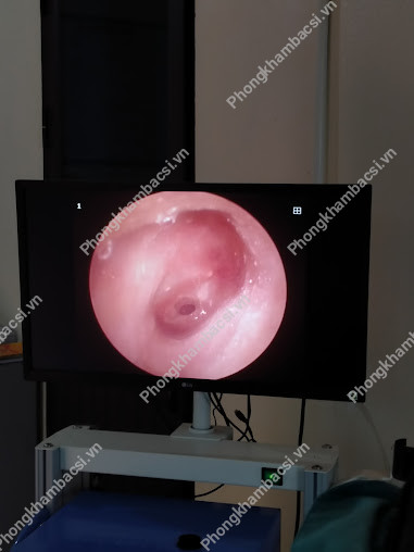 Phòng khám Tai Mũi Họng 79 - QL23, Thượng Thôn