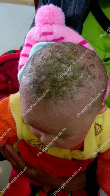 Phòng Khám Da Liễu Hùng Vương
