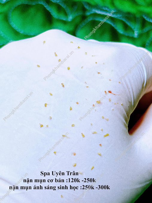 Spa Uyên Trân