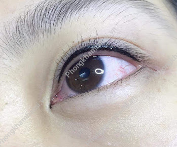 Thẩm Mỹ Quốc Tế Âu Mỹ