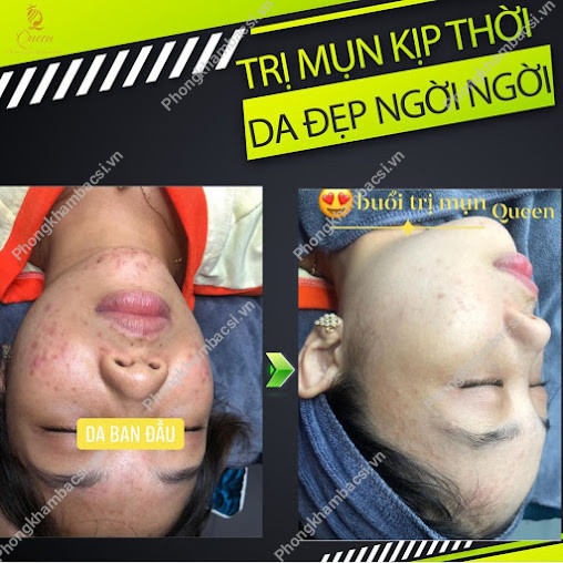 BeU Spa Hà Tĩnh