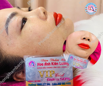 Thẩm Mỹ Viện Hoa Anh