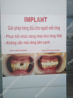 Nha Khoa Việt - Nhật