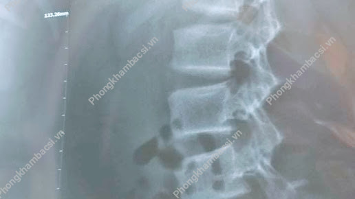 Phòng Khám Vật Lý Trị Liệu - Thần Kinh Cột Sống - Khu Phố Bình Phước