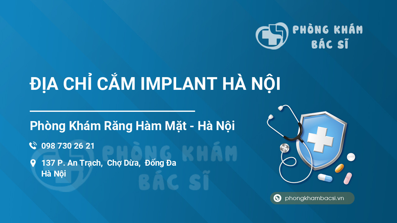 ĐỊA CHỈ CẮM IMPLANT HÀ NỘI