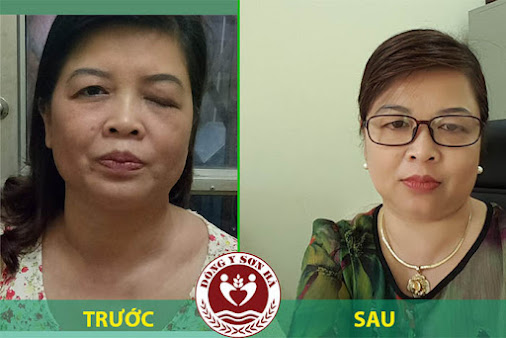 Đông Y Sơn Hà