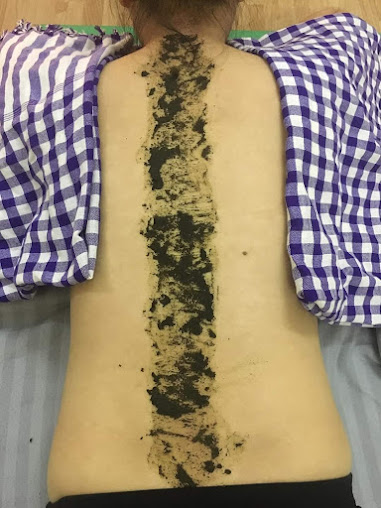 Massage - Vật Lý Trị Liệu - 120/12 cống lỡ, trịnh đình trọng, Phường 15, Quận Tân Bình