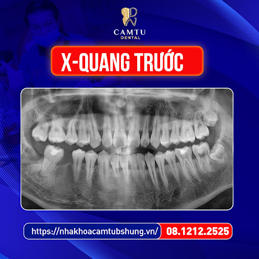 Nha Khoa Cẩm Tú