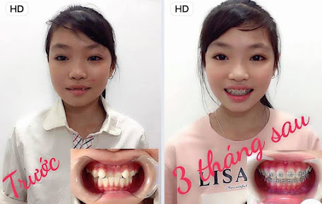 Phòng Khám Nha Khoa Khoa Đạt - BS Phùng Đăng Khoa
