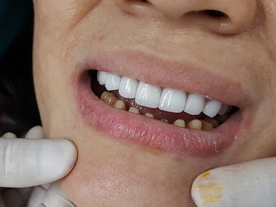 Phòng khám Nha Khoa Lam Anh - 329 Đ. Cách Mạng Tháng 8, Phường 12