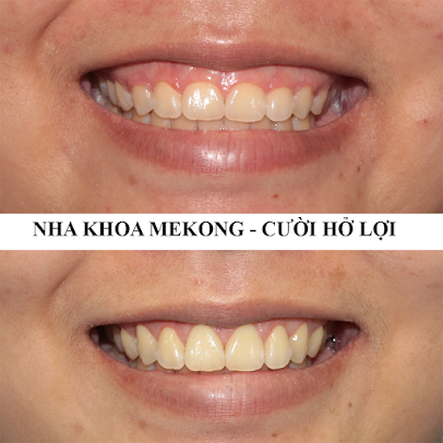 Nha khoa Mekong