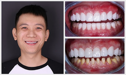 Nha Khoa Mỹ Đức