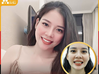 Nha Khoa Thẩm Mỹ Delia