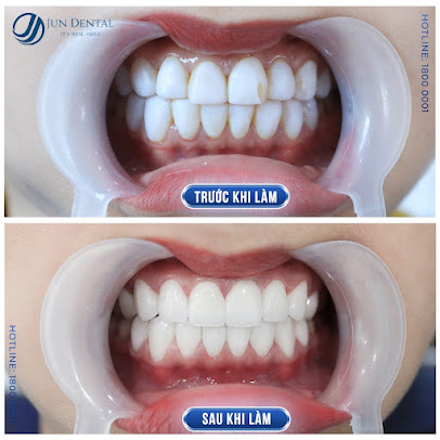 Nha Khoa Thẩm Mỹ Quốc Tế Jun Dental