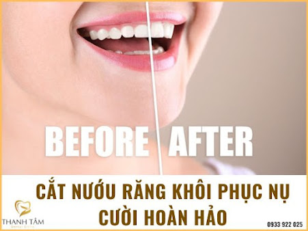 Nha Khoa Thanh Tâm