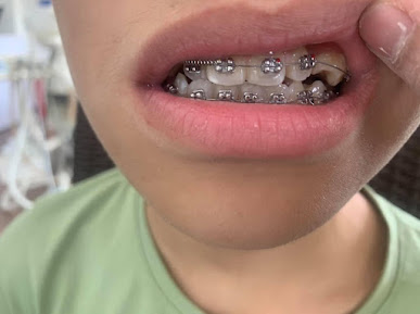 Nha Khoa Trường Thịnh