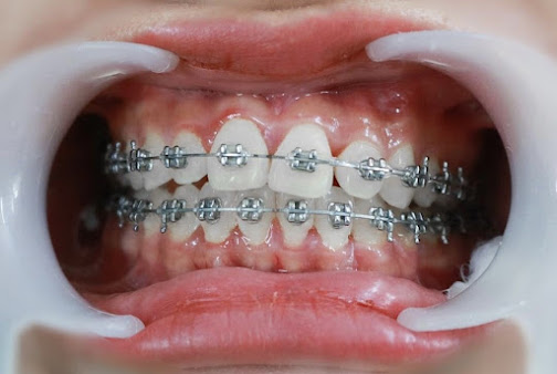 Phòng khám Nha Khoa Quốc Tế VinSmile