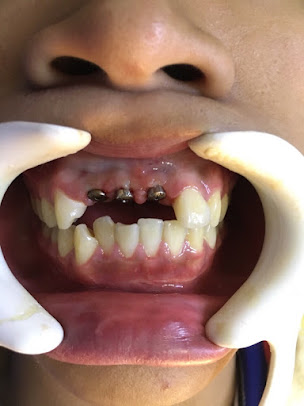 Phòng Khám Răng Hàm Mặt - BS Trần Lưu Đóa