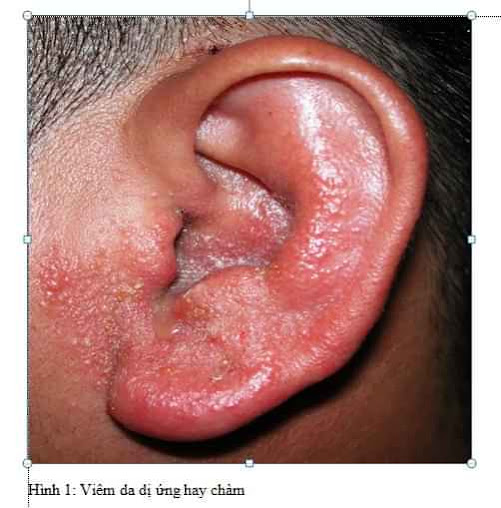 Phòng Khám Tai Mũi Họng - BS Long