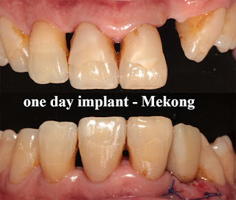 Nha Khoa Mekong Dental