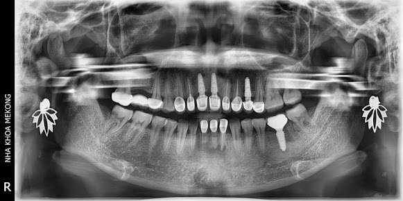 Nha Khoa Mekong Dental